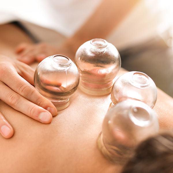 Woman therapist hands giving cupping treatment